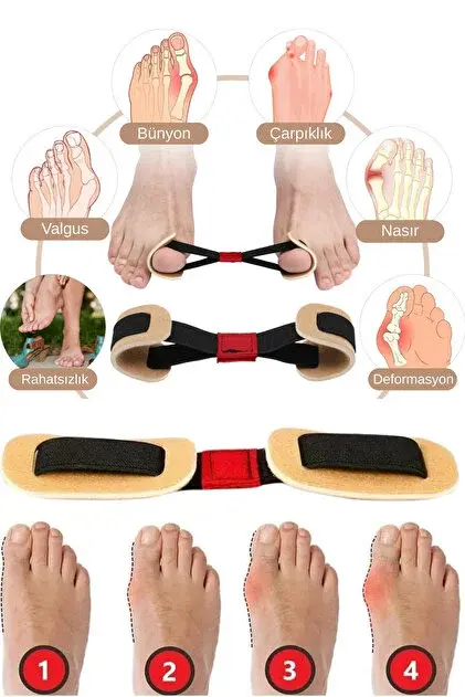 Ayak Baş Parmak Egzersiz Lastiği